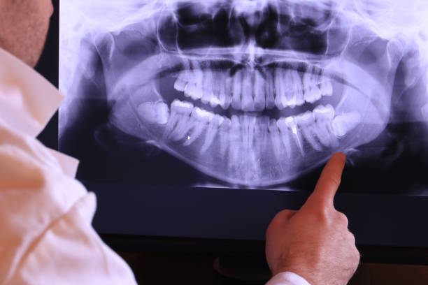 Best Emergency Treatment for Dental Infections or Abscesses in Energy, IL